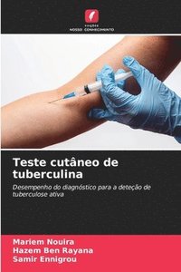 bokomslag Teste cutneo de tuberculina