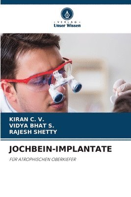 bokomslag Jochbein-Implantate