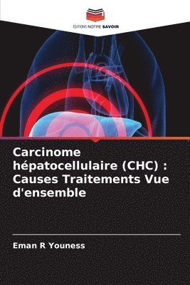 bokomslag Carcinome hpatocellulaire (CHC)