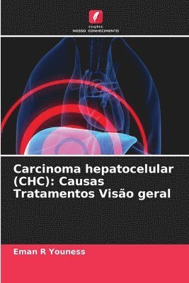 Eman R Youness, Eman R. Youness - Carcinoma hepatocelular (CHC), Häftad