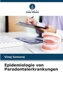 bokomslag Epidemiologie von Parodontalerkrankungen