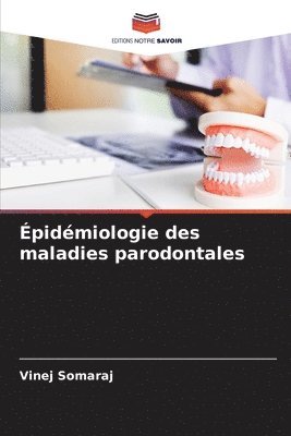 Épidémiologie des maladies parodontales 1