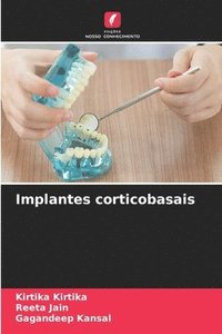 bokomslag Implantes corticobasais