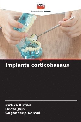 bokomslag Implants corticobasaux