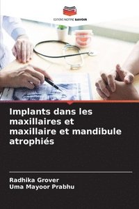 bokomslag Implants dans les maxillaires et maxillaire et mandibule atrophis