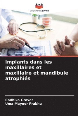 bokomslag Implants dans les maxillaires et maxillaire et mandibule atrophis