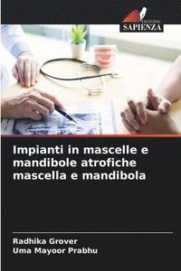 bokomslag Impianti in mascelle e mandibole atrofiche mascella e mandibola