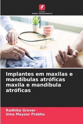 bokomslag Implantes em maxilas e mandbulas atrficas maxila e mandbula atrficas