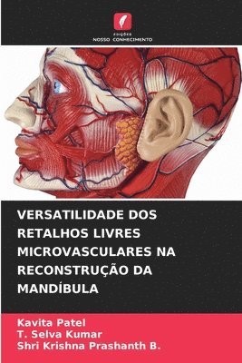 Kavita Patel, T Selva Kumar, Shri Krishna Prashanth B - Versatilidade DOS Retalhos Livres Microvasculares Na Reconstrução Da Mandíbula, Häftad