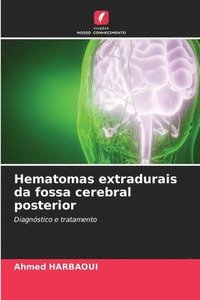 bokomslag Hematomas extradurais da fossa cerebral posterior