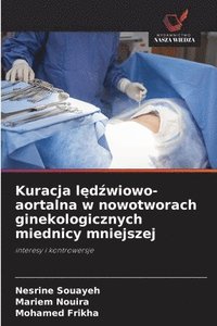 bokomslag Kuracja l&#281;d&#378;wiowo-aortalna w nowotworach ginekologicznych miednicy mniejszej