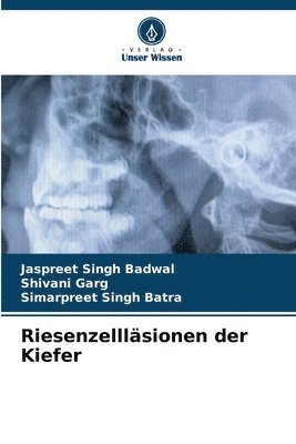 Jaspreet Singh Badwal, Shivani Garg, Simarpreet Singh Batra - Riesenzellläsionen der Kiefer, Häftad