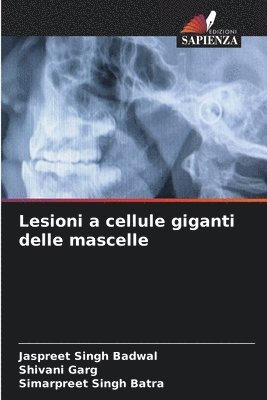 Lesioni a cellule giganti delle mascelle 1