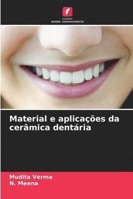 Material e aplicaes da cermica dentria 1