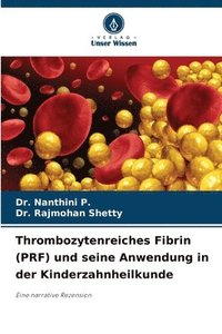 bokomslag Thrombozytenreiches Fibrin (PRF) und seine Anwendung in der Kinderzahnheilkunde