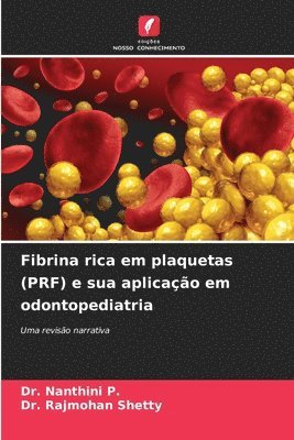 bokomslag Fibrina rica em plaquetas (PRF) e sua aplicao em odontopediatria