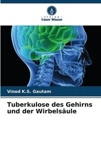 bokomslag Tuberkulose des Gehirns und der Wirbelsäule