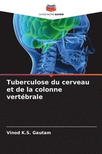 bokomslag Tuberculose du cerveau et de la colonne vertbrale