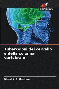 bokomslag Tubercolosi del cervello e della colonna vertebrale