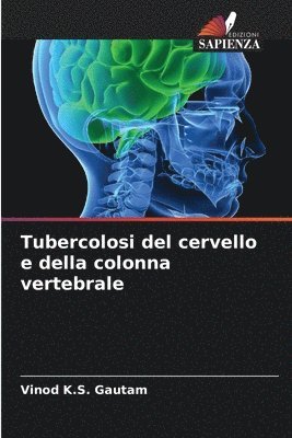 Tubercolosi del cervello e della colonna vertebrale 1