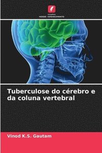 bokomslag Tuberculose do cérebro e da coluna vertebral