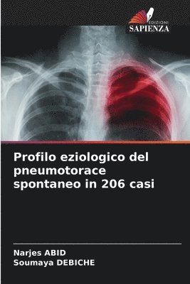 Profilo eziologico del pneumotorace spontaneo in 206 casi