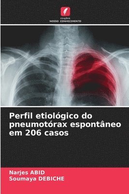 Perfil etiológico do pneumotórax espontâneo em 206 casos 1