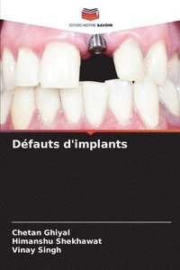 bokomslag Dfauts d'implants