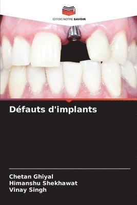 bokomslag Défauts d'implants