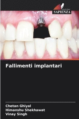 Fallimenti implantari