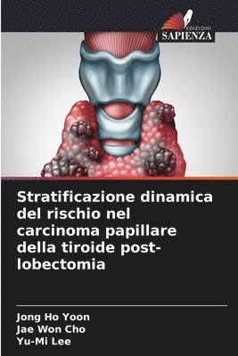 bokomslag Stratificazione dinamica del rischio nel carcinoma papillare della tiroide post-lobectomia