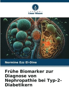 Frühe Biomarker zur Diagnose von Nephropathie bei Typ-2-Diabetikern