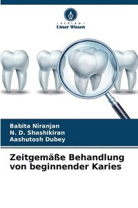 bokomslag Zeitgeme Behandlung von beginnender Karies