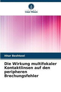 bokomslag Die Wirkung multifokaler Kontaktlinsen auf den peripheren Brechungsfehler