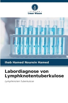 bokomslag Labordiagnose von Lymphknotentuberkulose