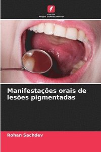 bokomslag Manifestaes orais de leses pigmentadas