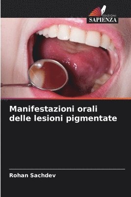 bokomslag Manifestazioni orali delle lesioni pigmentate