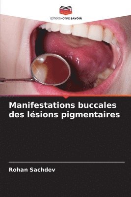 bokomslag Manifestations buccales des lésions pigmentaires