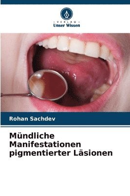 Mndliche Manifestationen pigmentierter Lsionen 1