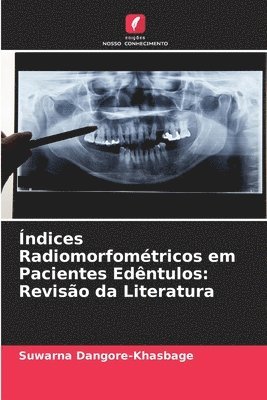 ndices Radiomorfomtricos em Pacientes Edntulos 1