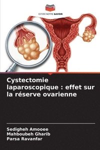 bokomslag Cystectomie laparoscopique: effet sur la réserve ovarienne