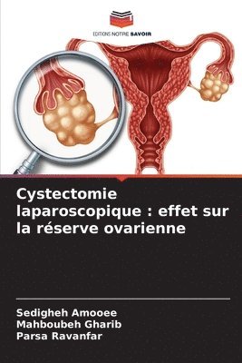 Cystectomie laparoscopique 1