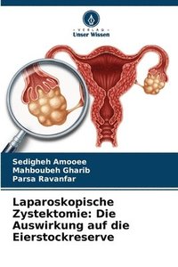 bokomslag Laparoskopische Zystektomie: Die Auswirkung auf die Eierstockreserve