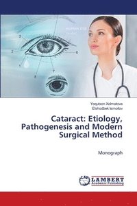 bokomslag Cataract: Etiology, Pathogenesis and Modern Surgical Method