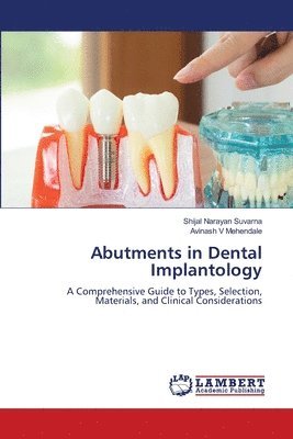 bokomslag Abutments in Dental Implantology