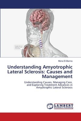 bokomslag Understanding Amyotrophic Lateral Sclerosis