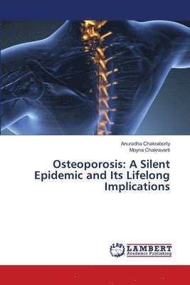 bokomslag Osteoporosis