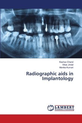 bokomslag Radiographic aids in Implantology