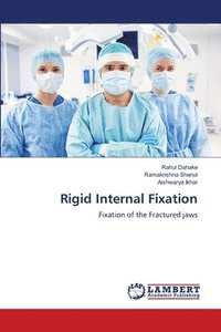 bokomslag Rigid Internal Fixation