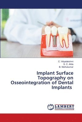 bokomslag Implant Surface Topography on Osseointegration of Dental Implants